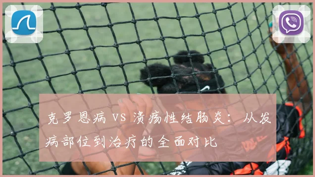 克罗恩病 vs 溃疡性结肠炎:从发病部位到治疗的全面对比